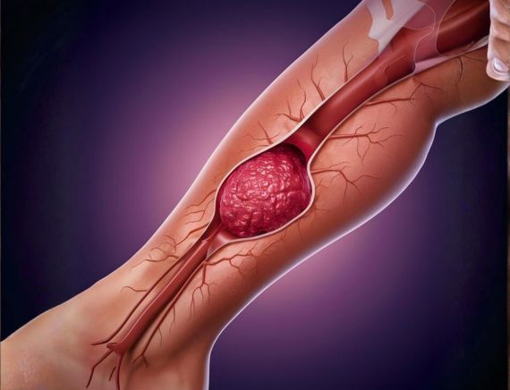 Gall Bladder Treatment